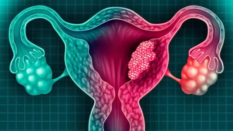 cancer cervis